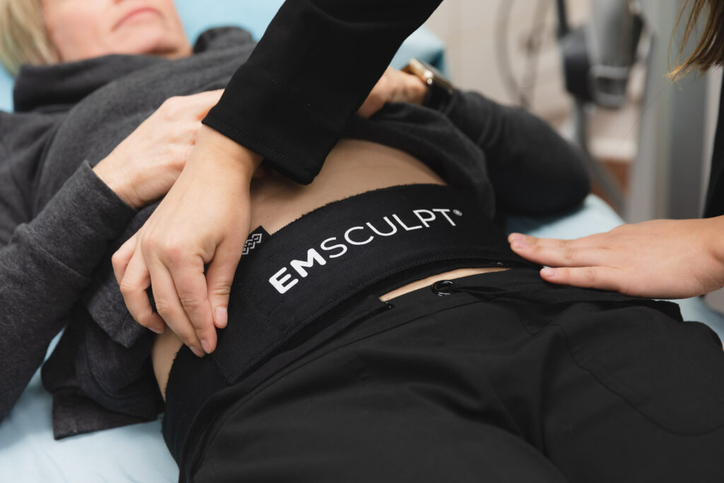 preparing for Emsculpt, a treatment for body contouring in Birmingham, AL