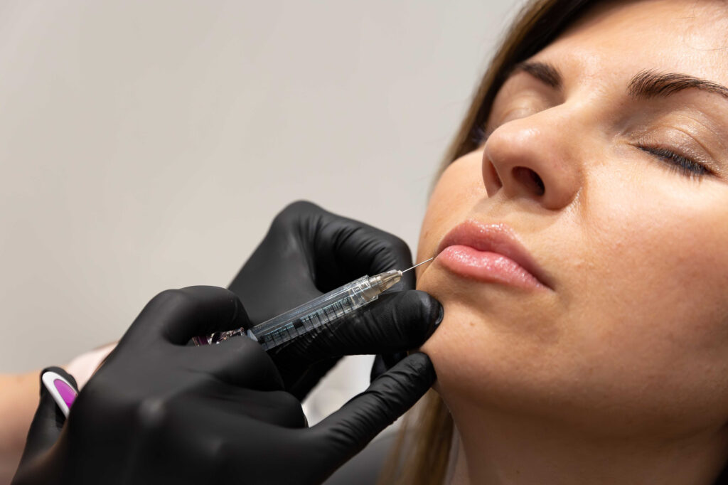 Close up of an injector with black gloves administering lip filler in Homewood for a female patient