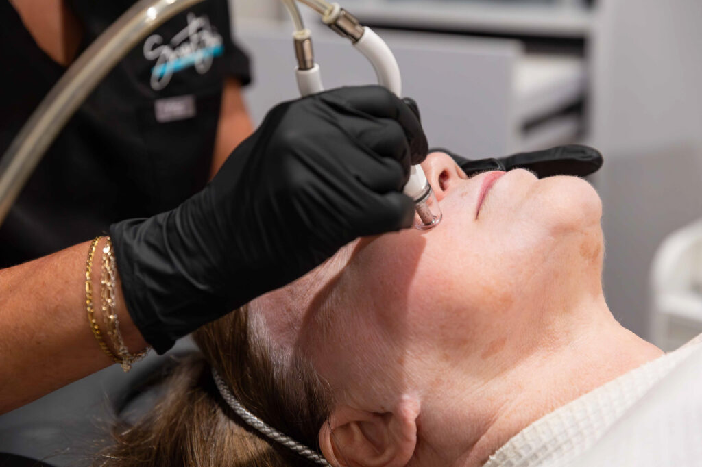 Close up of a woman laying down, receiving a DiamondGlow facial, which is the best facial for dark spots in Hoover