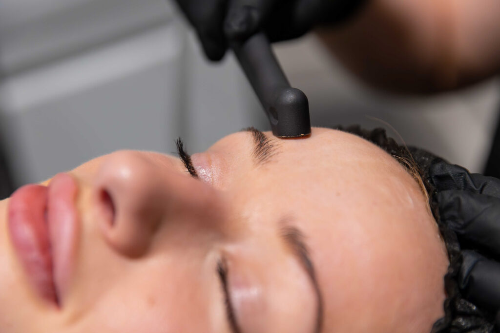 Close up of a young woman getting a salt facial for rosacea treatment in Birmingham