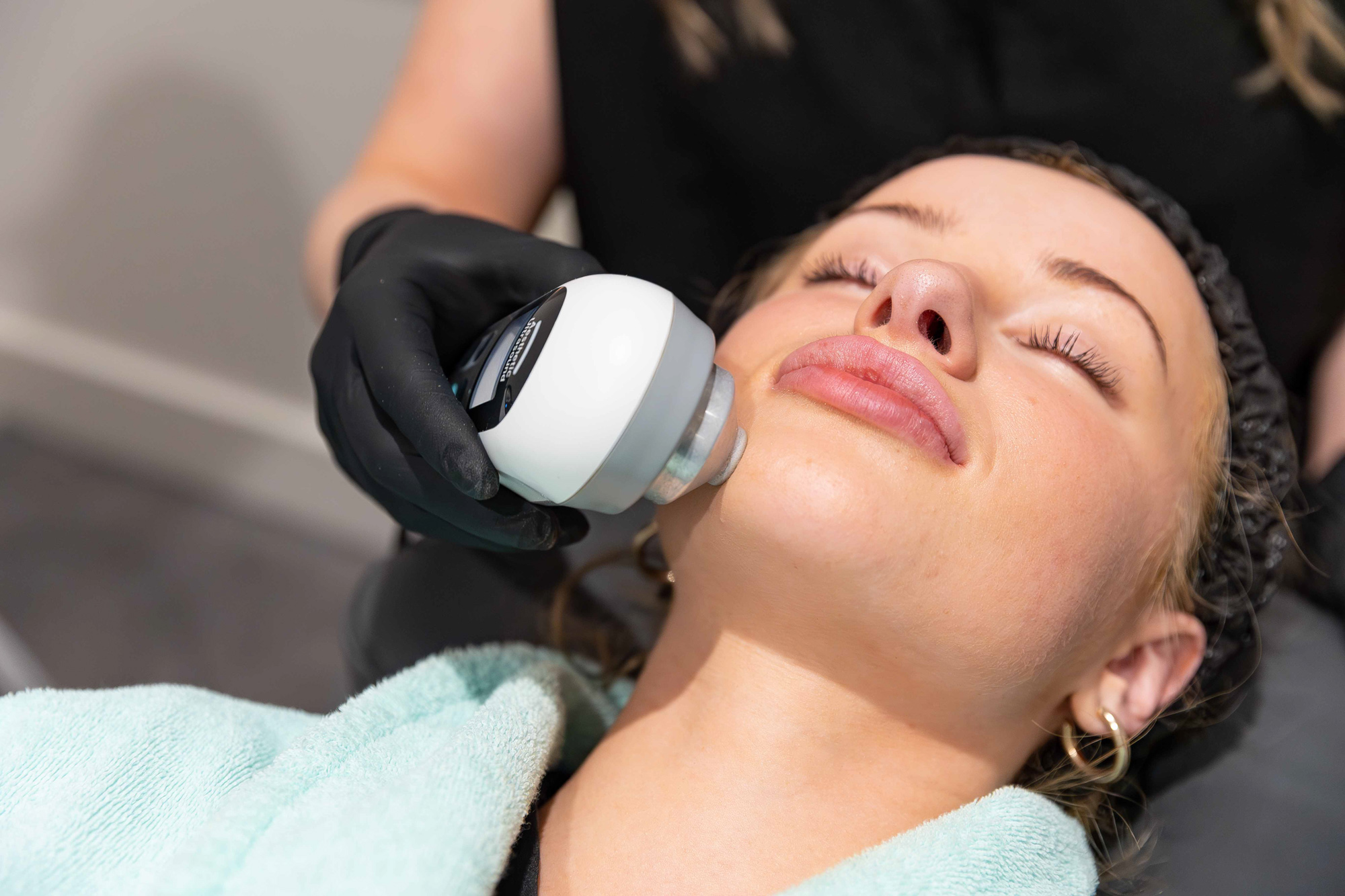 Close up of a young woman reciving a facial in Hoover at Smart Skin Med Spa