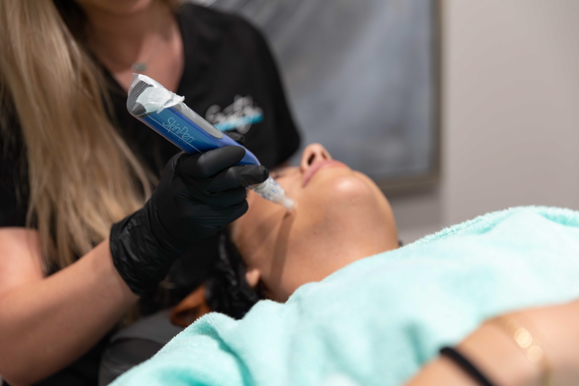 A woman receiving a skin treatment using SkinPen microneedling technology