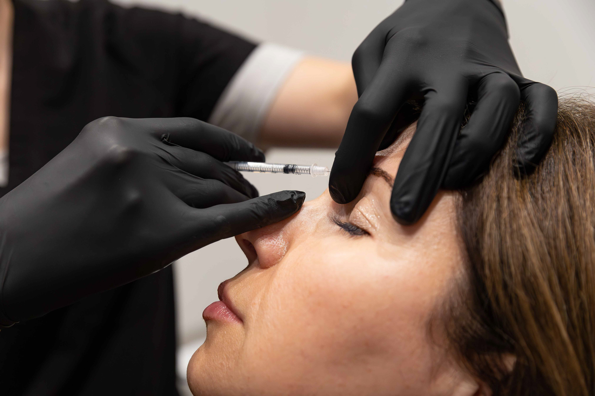 Close up of a woman experiencing facial contouring in Birmingham, Al via Botox