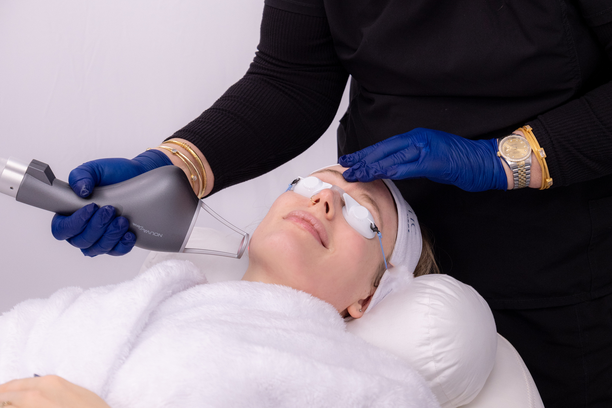 A Smart Skin Med Spa provider, wearing black scrubs and blue gloves, slowly moves the NOUVADerm device across a patient's face during laser resurfacing in Hoover.